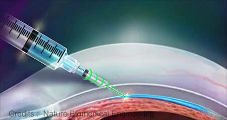 New Needle Invented for Tissue Targeted Drug Delivery
